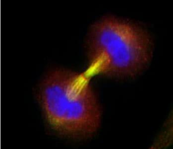 BIRC5 / Survivin Antibody