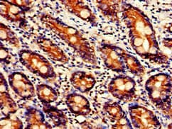 Polyclonal Rabbit anti-Human UGT1A9 Antibody (IHC, IF)