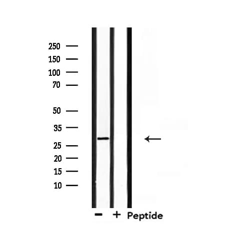 RNF144A / RNF144 Antibody