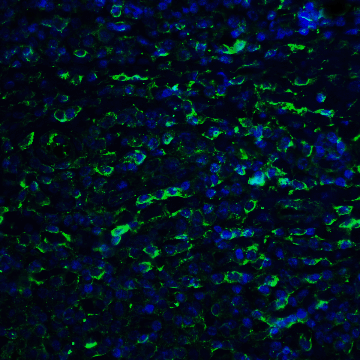 PathPlus™ PD-L2 / PDCD1LG2 / CD273 Antibody (clone 10H6)