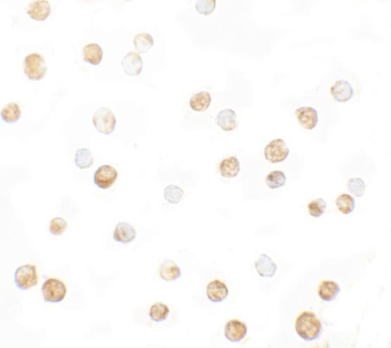 IHC-plus™ Polyclonal Rabbit anti-Human DNM1L / DRP1 Antibody (IHC, IF, WB)