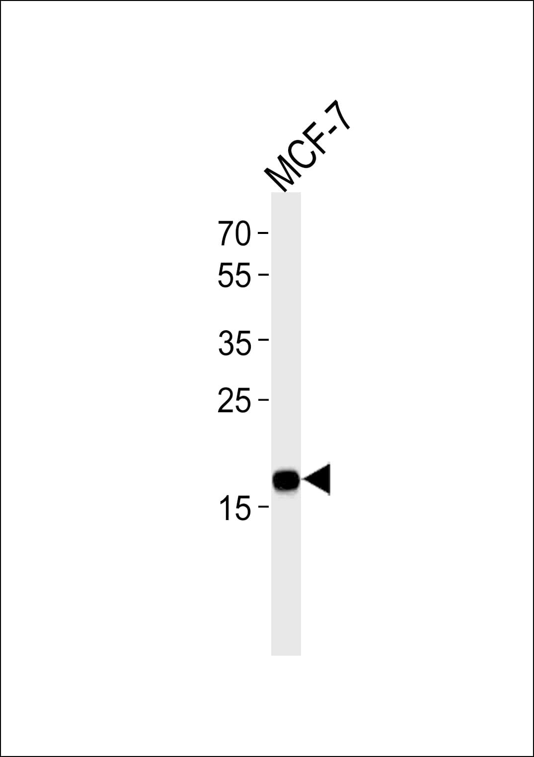 Monoclonal Mouse anti-Human NME1 / NM23 Antibody (clone 1172CT2.4.1.1, WB)