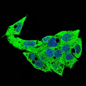 SDC1 / Syndecan 1 / CD138 Antibody (aa28-171, clone 1A3H4)
