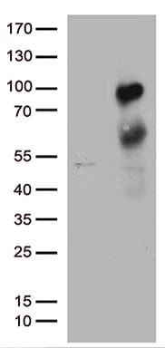 Monoclonal Mouse anti-Human MBD1 Antibody (clone OTI1A1, aa222-556, WB)