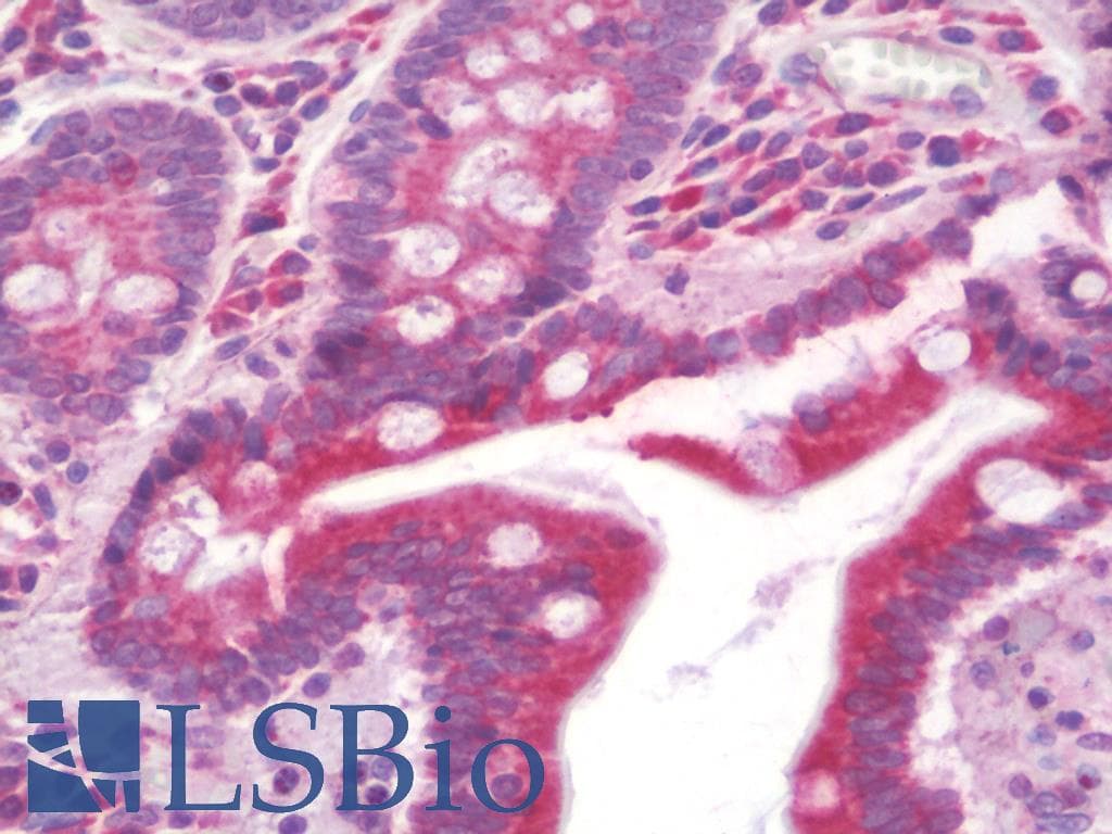 IHC-plus™ TUBGCP4 Antibody (aa191-240)
