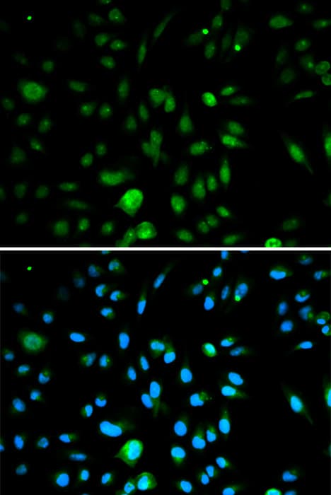 Polyclonal Rabbit anti-Human p16INK4a / CDKN2A Antibody (IHC, IF, WB)