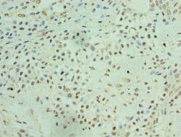 p84 / THOC1 Antibody (aa428-657)