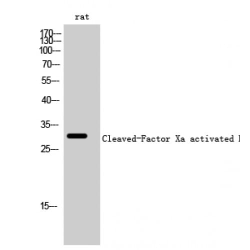 Polyclonal Rabbit anti-Human F10 / Factor X Antibody (190-270 aa, Internal, WB)