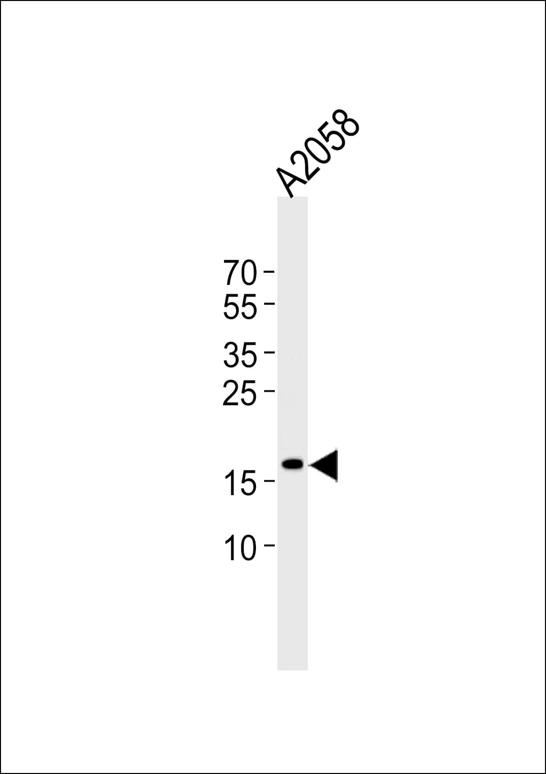 SNX3 Antibody (aa78-105)
