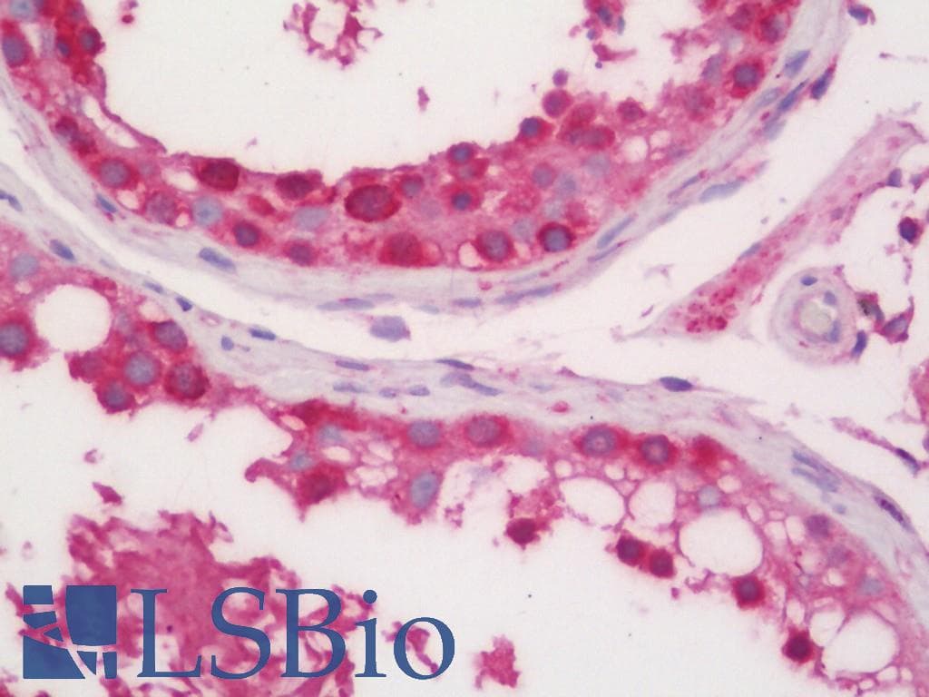 IHC-plus™ MSTN / GDF8 / Myostatin Antibody (aa25-55)