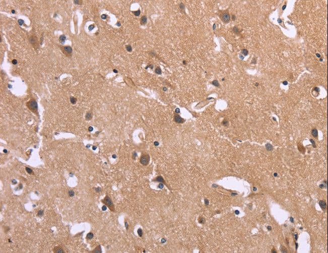SLC52A1 / GPR172B / PAR2 Antibody