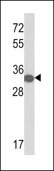 His Tag Antibody