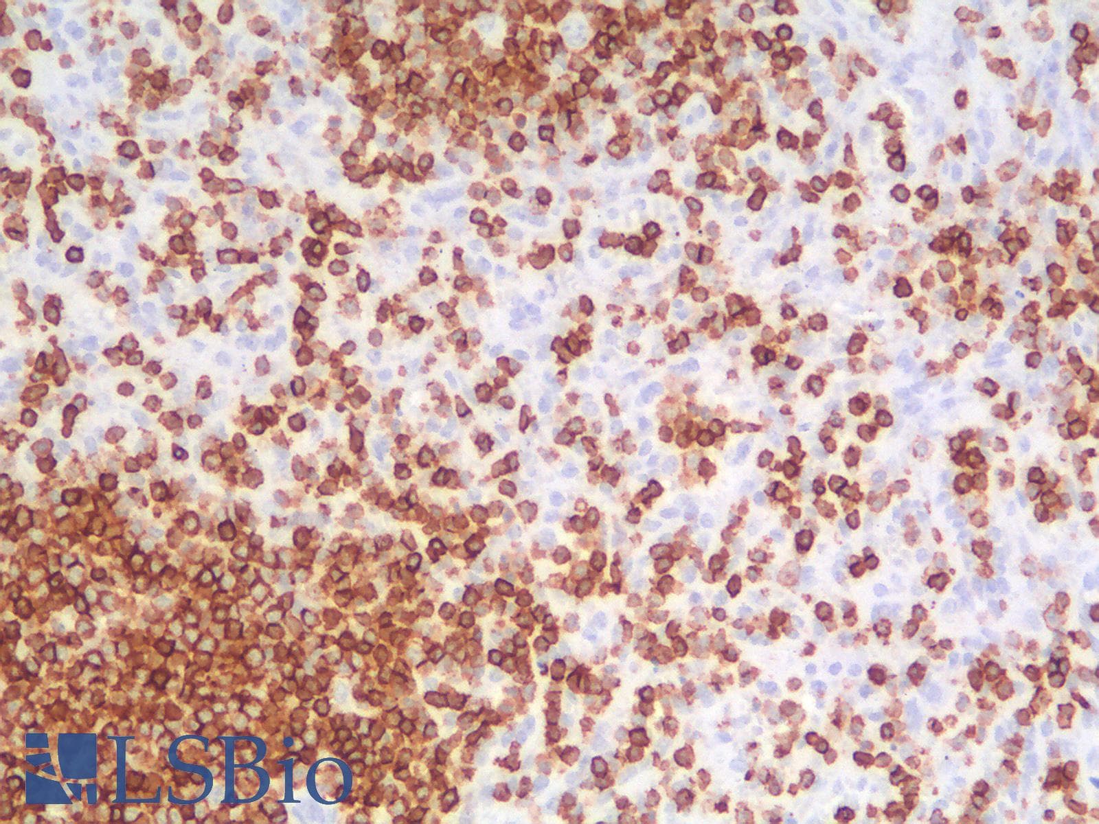 PathPlus™ Recombinant Monoclonal Rabbit anti-Human CD45 / LCA Antibody (clone PTPRC/1975R, IHC, WB)