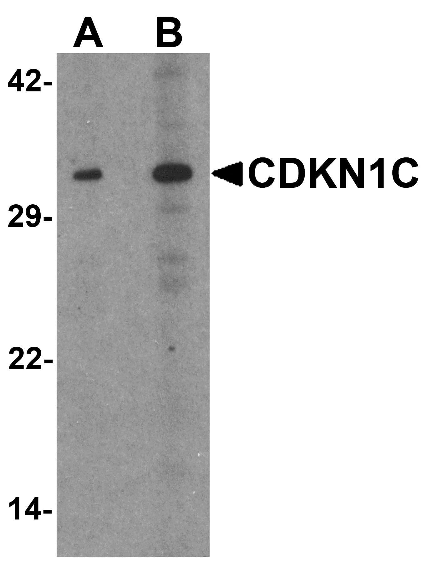 PathPlus™ CDKN1C / p57 Kip2 Antibody
