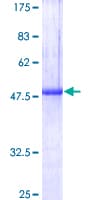 Human USAG1 / SOSTDC1 Protein (Recombinant GST)
