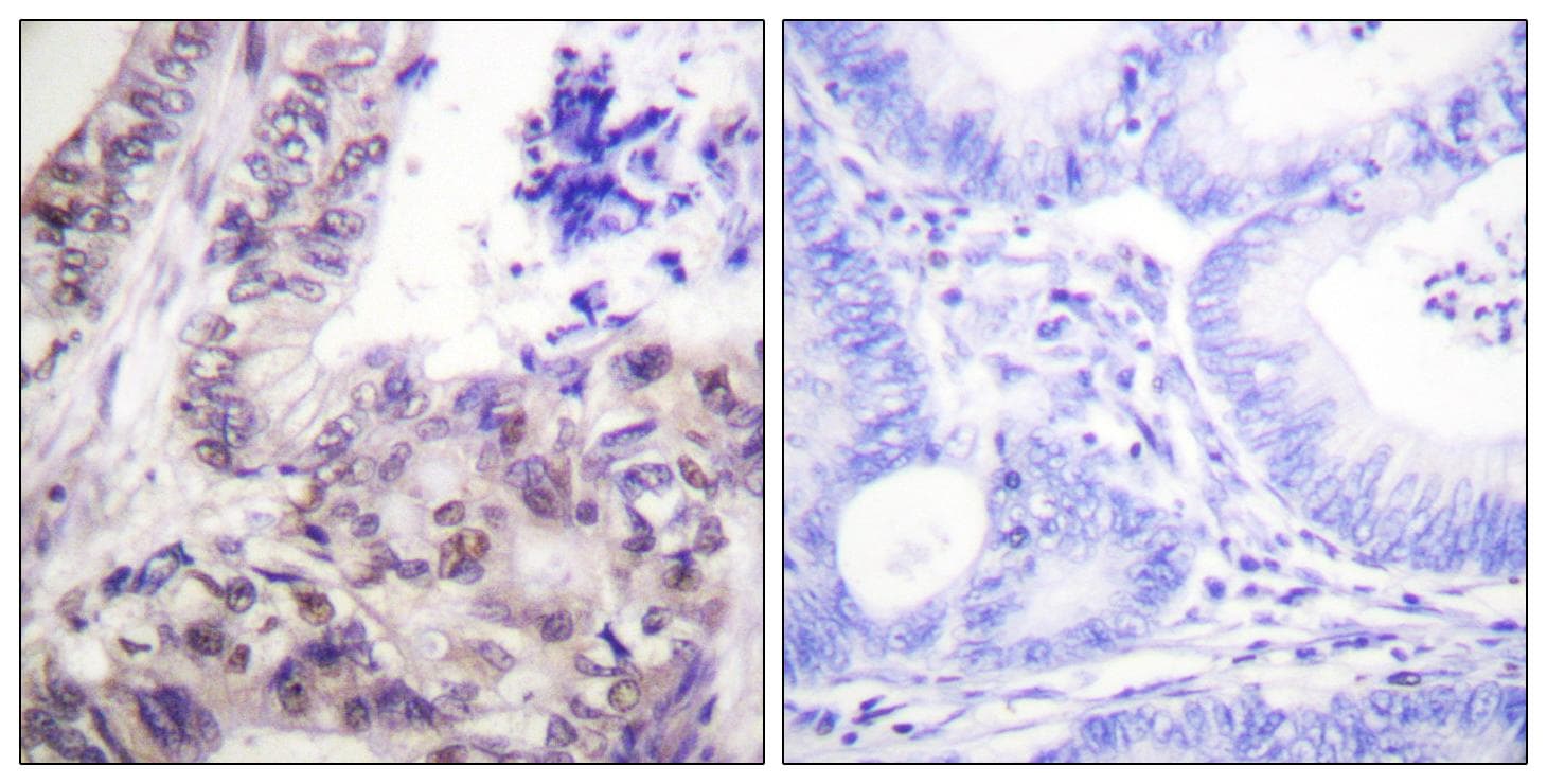 CASP9 / Caspase 9 Antibody (phospho-Ser144)