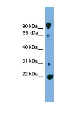 KLHL2 / MAV Antibody (aa179-228)