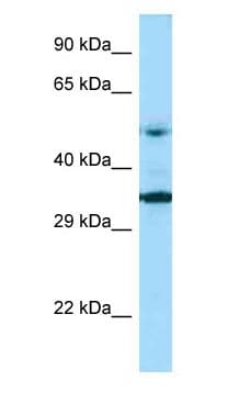 Polyclonal Rabbit anti-Human PNPLA2 / ATGL Antibody (aa243-292, WB)