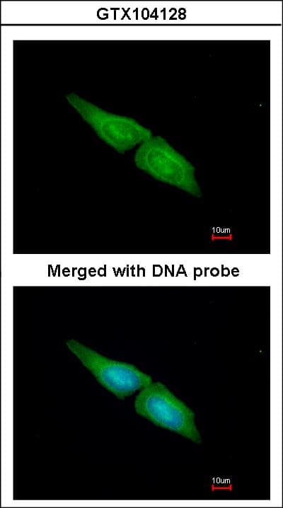IHC-plus™ MAPK4 / ERK4 Antibody (aa1-326)