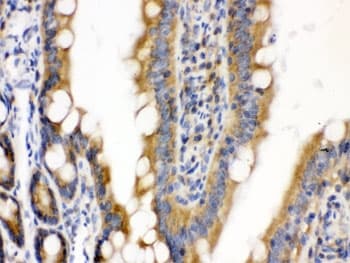 Polyclonal Rabbit anti-Human CDCP1 Antibody (IHC, WB)