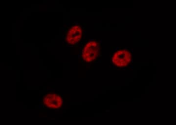 CMPK / CMPK1 Antibody