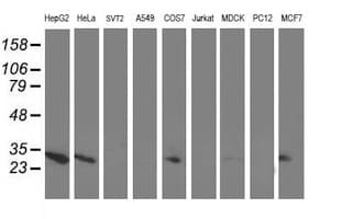 AK4 / Adenylate Kinase 4 Antibody (clone OTI2B12)