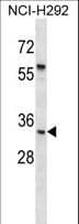 TSPAN20 / UPK1B Antibody (aa160-188)