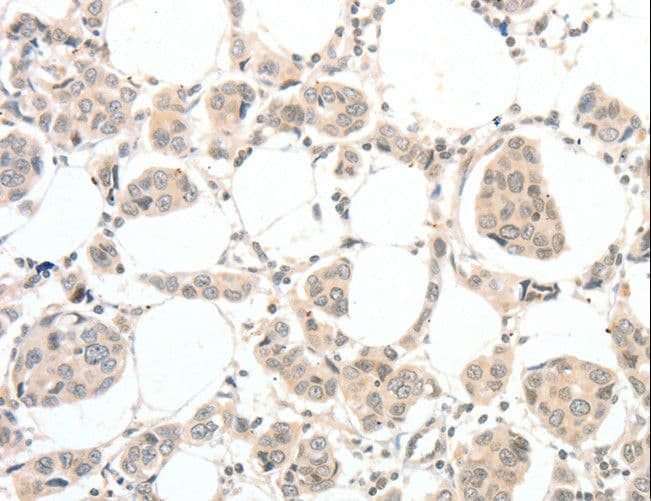 Polyclonal Rabbit anti-Human TSPYL2 / DENTT Antibody (IHC)