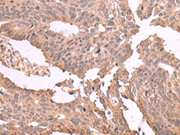 Polyclonal Rabbit anti-Human MAGEC2 / CT10 Antibody (IHC, WB)