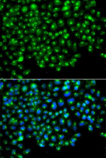 GOPC / PIST Antibody