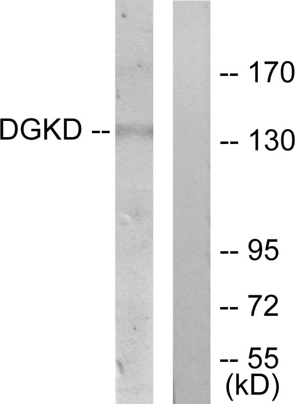 Polyclonal Rabbit anti-Human DGKD Antibody (aa41-90, WB)