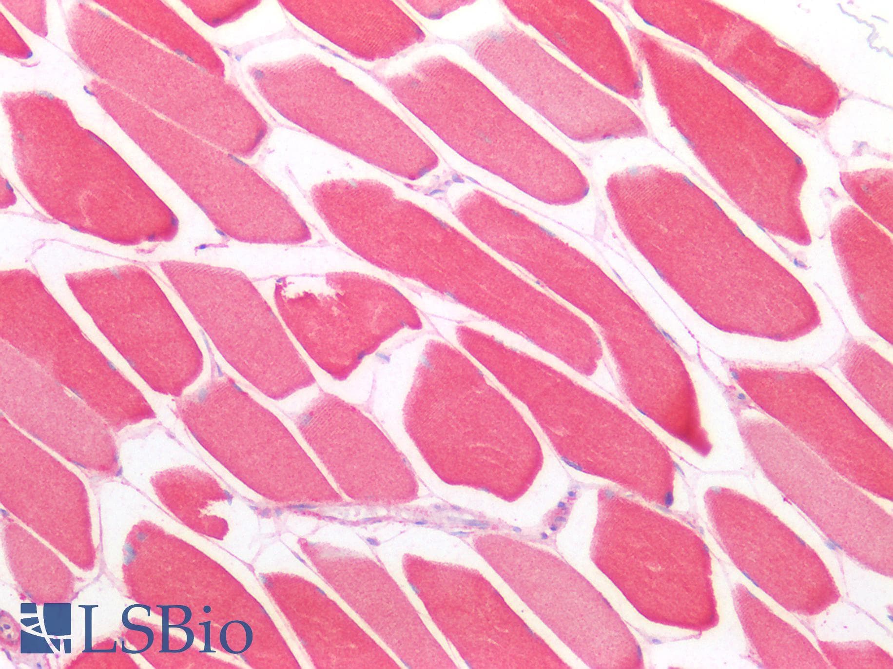 Polyclonal Rabbit anti-Mouse CD302 Antibody (aa21-225, IHC, WB)