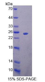 Mouse MTF-1 Protein (Recombinant His-T7)