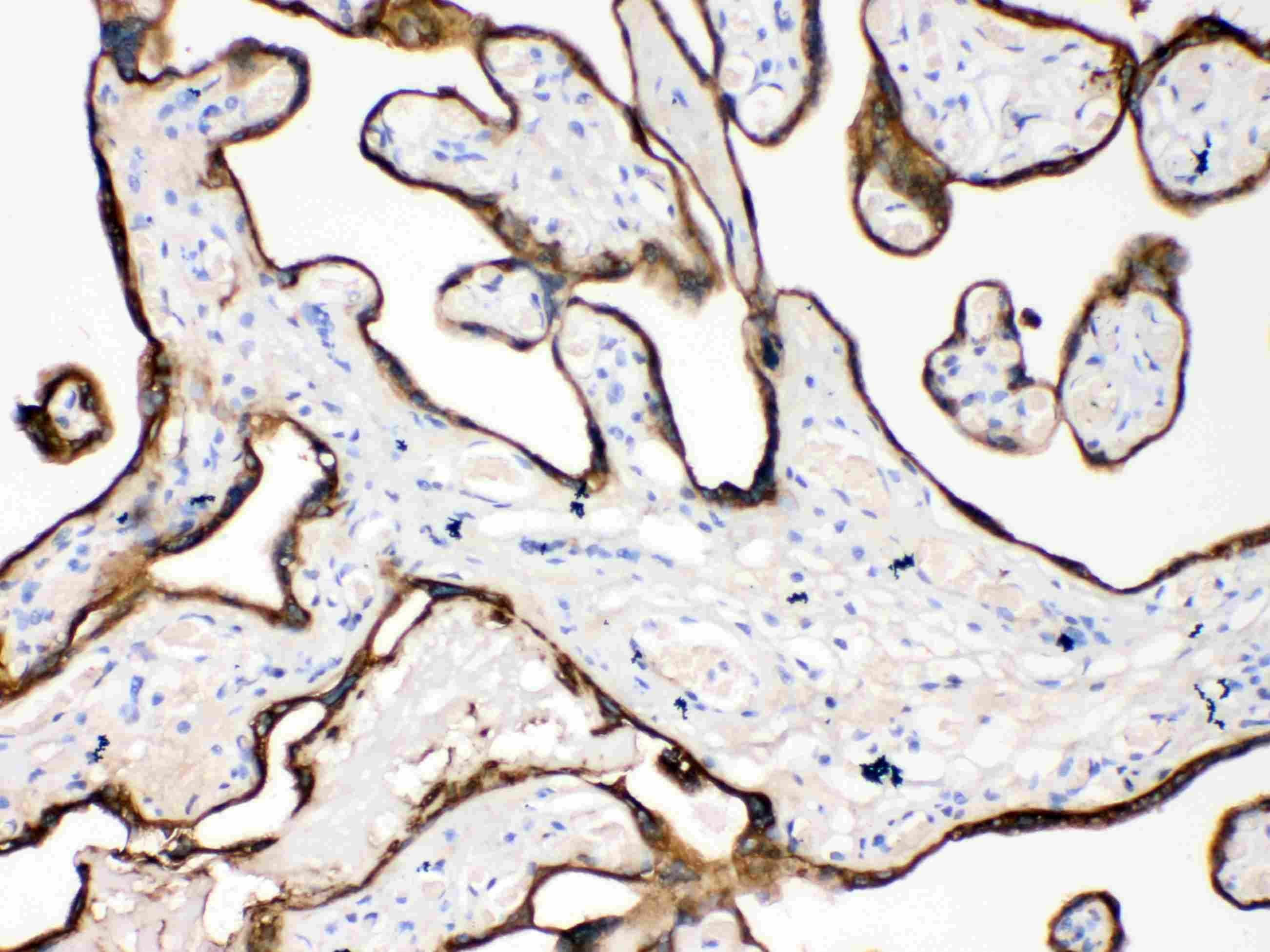 KRT18 / CK18 / Cytokeratin 18 Antibody