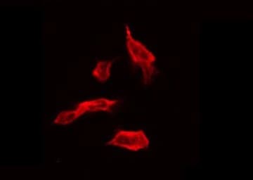 Polyclonal Rabbit anti-Human PPP1R14A / CPI-17 Antibody (phospho-Thr38, IHC, IF, WB)