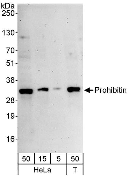 IHC-plus™ PHB / Prohibitin Antibody (aa222-272)
