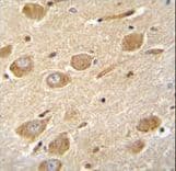Polyclonal Rabbit anti-Human CNGA4 Antibody (aa131-160, IHC, WB)