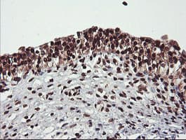 COPS5 / JAB1 Antibody (clone OTI2B12)