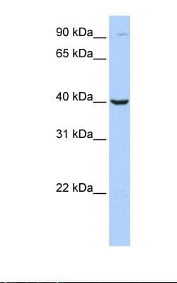 ARG2 / Arginase 2 Antibody (C-Terminus)