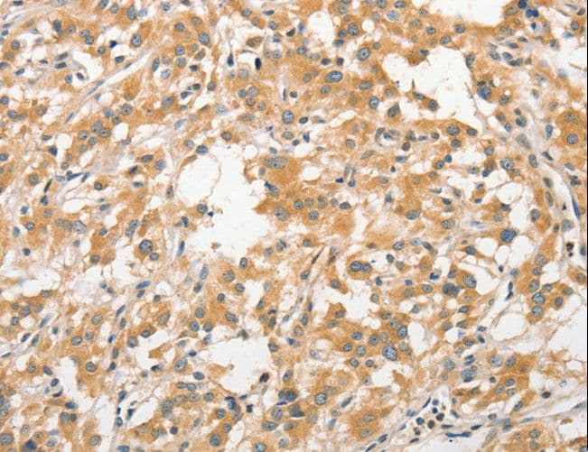 ANAPC5 / APC5 Antibody