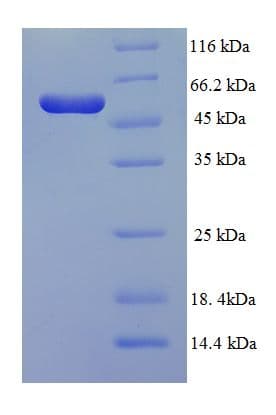 Human NR1I3 / CAR Protein (Recombinant His-SUMO)