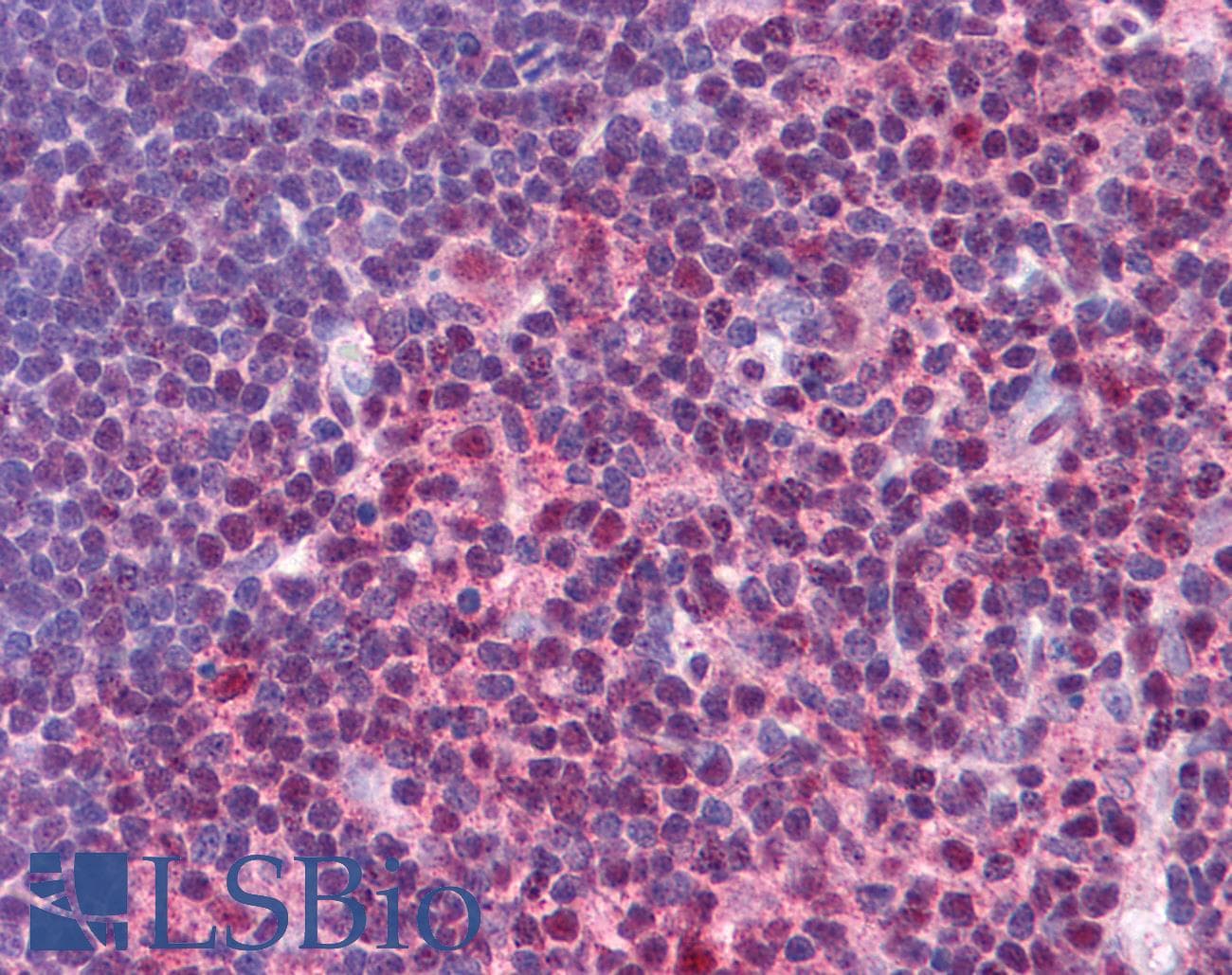 STAT3 Antibody (aa683-732)