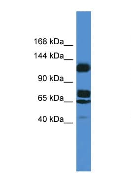 HTS1 / ST5 Antibody (aa387-436)