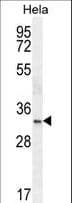 PathPlus™ NKX2-1 / Thyroid-Specific TF Antibody (aa1-30)