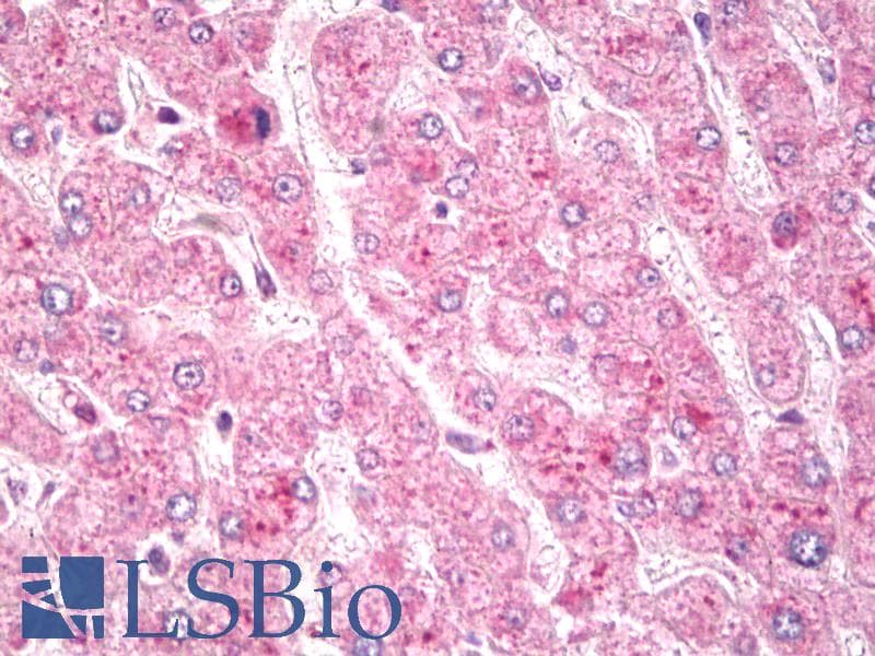 IHC-plus™ c-Met Antibody (aa1316-1365)