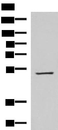 FDXR Antibody