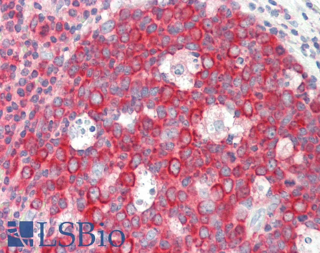 IHC-plus™ RPL4 / Ribosomal Protein L4 Antibody (clone 4A3)