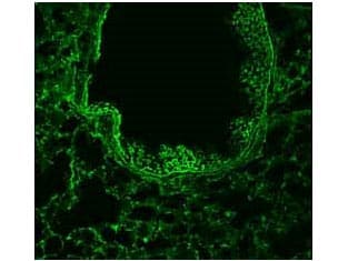 Polyclonal Rabbit anti-Human ROBO1 Antibody (aa1625-1650, IHC, IF, WB)