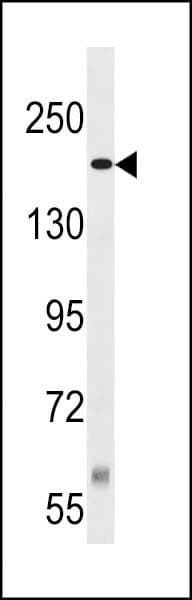 Tuberin / TSC2 Antibody (aa1364-1393)