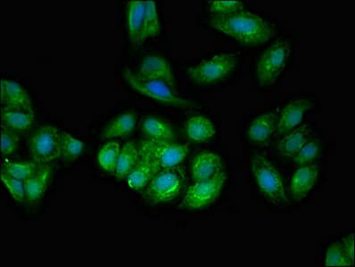 TPD52L2 / HD54 Antibody